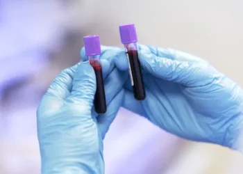5 Reasons Regular Blood Tests Are Essential for Your Health