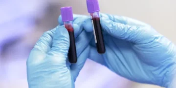 5 Reasons Regular Blood Tests Are Essential for Your Health
