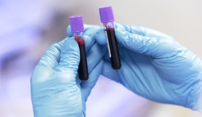 5 Reasons Regular Blood Tests Are Essential for Your Health