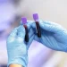 5 Reasons Regular Blood Tests Are Essential for Your Health