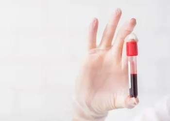 How Blood Tests Can Help You Personalize Your Supplement Plan