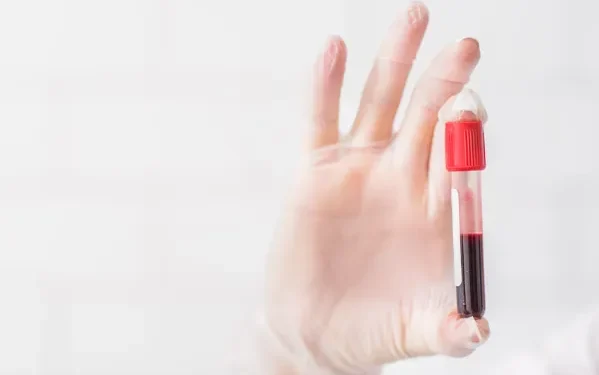 How Blood Tests Can Help You Personalize Your Supplement Plan