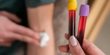 A Complete Guide to Understanding Your Blood Test Results