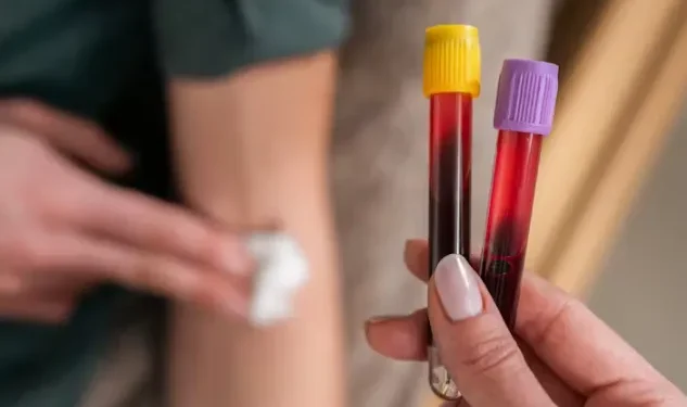 A Complete Guide to Understanding Your Blood Test Results