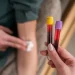 A Complete Guide to Understanding Your Blood Test Results