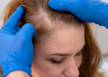The Link Between Thyroid Health and Your Hair