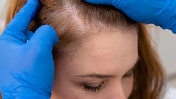 The Link Between Thyroid Health and Your Hair