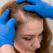 The Link Between Thyroid Health and Your Hair
