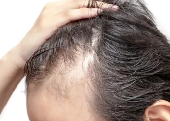 Is Stress the Reason Your Hair Is Thinning?