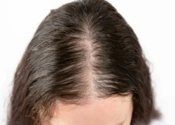 How Much Hair Loss Is Normal and When to Be Concerned