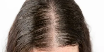 How Much Hair Loss Is Normal and When to Be Concerned
