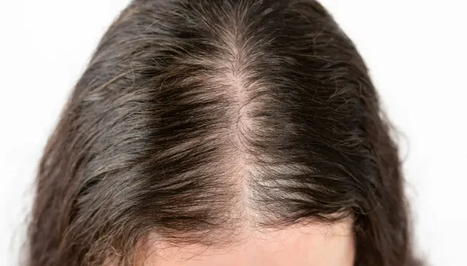 How Much Hair Loss Is Normal and When to Be Concerned