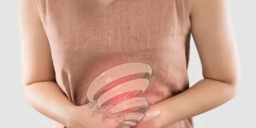 Understanding Irritable Bowel Syndrome (IBS) and the Role of Probiotics in Managing Symptoms