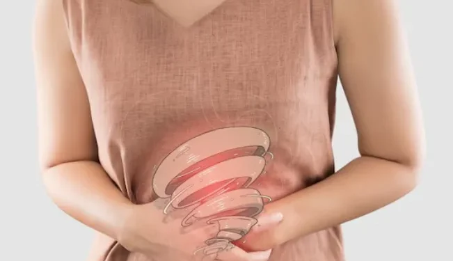 Understanding Irritable Bowel Syndrome (IBS) and the Role of Probiotics in Managing Symptoms