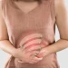 Understanding Irritable Bowel Syndrome (IBS) and the Role of Probiotics in Managing Symptoms